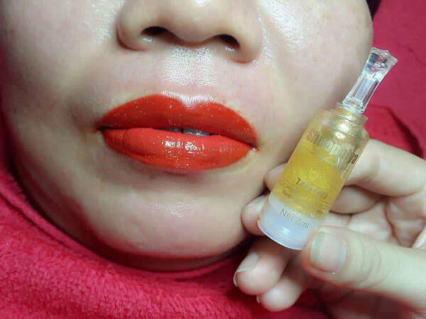 môi collagen