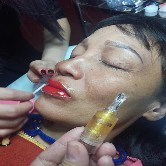 phun môi collagen