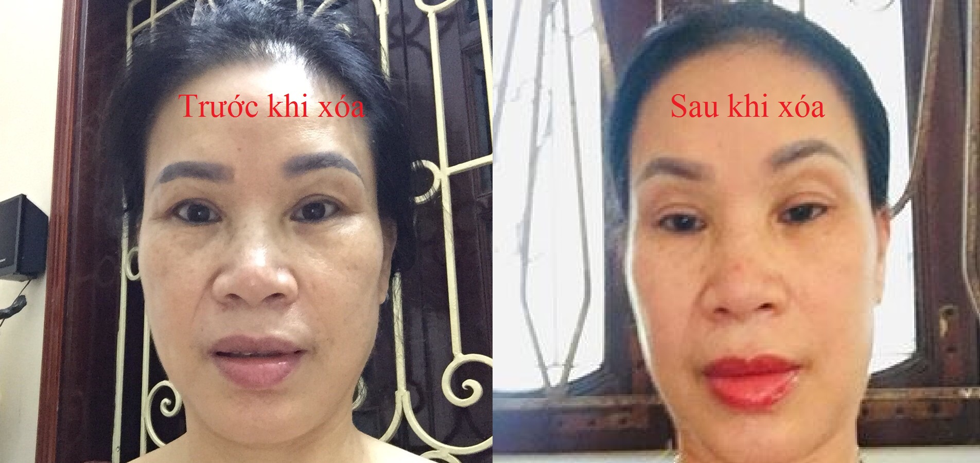 hạ tone màu