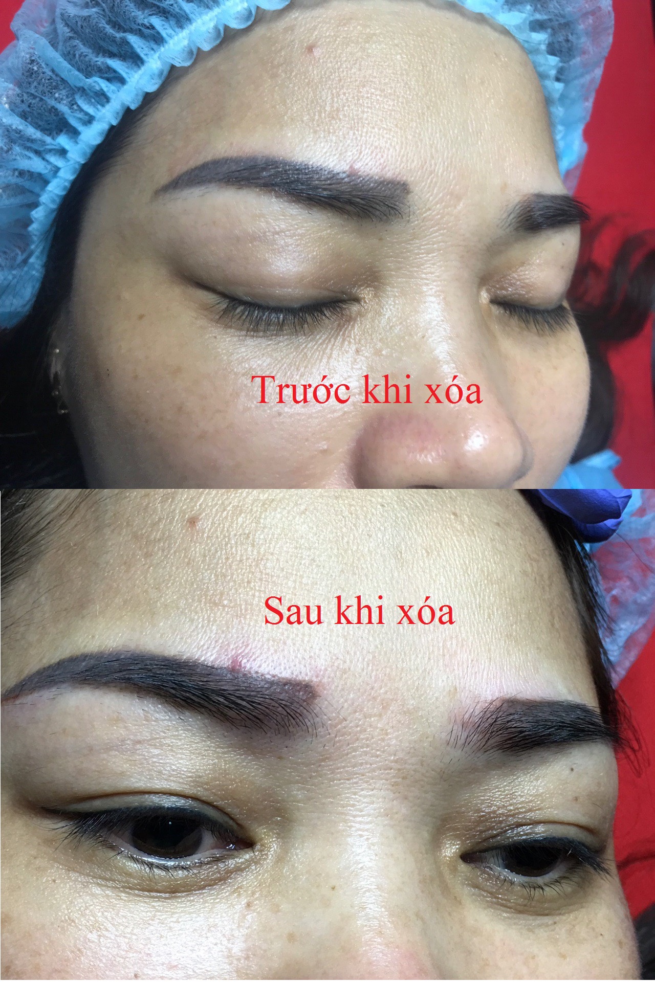 Dùng dung dịch hạ tone màu 
