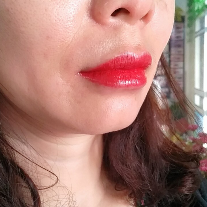Tê JS chống sưng