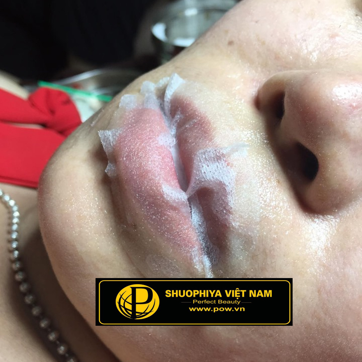 Ủ tê môi dán miếng Pow